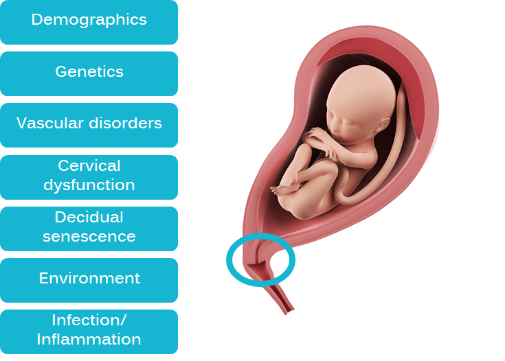esquema causas prematuridad